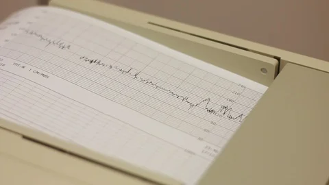 The electrocardiogram device prints a sheet with the results of the analysis Stock Footage 126357082