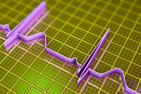 Electrocardiogram, ECG background Illustrazione stock