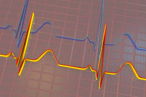Electrocardiogram, ECG background Illustrazione stock
