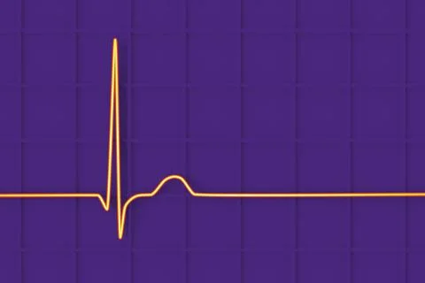 Electrocardiogram ECG displaying a junctional rhythm, 3D illustration Stock-Illustration