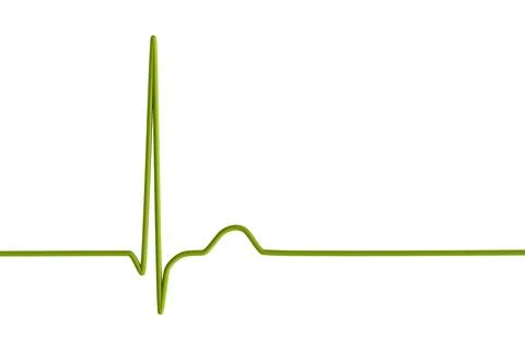 Electrocardiogram ECG displaying a junctional rhythm, 3D illustration Stock-Illustration