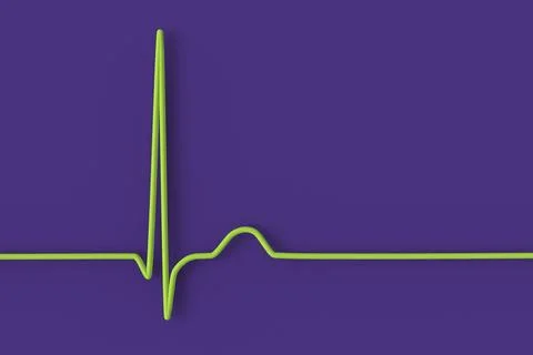 Electrocardiogram ECG displaying a junctional rhythm, 3D illustration Stock-Illustration