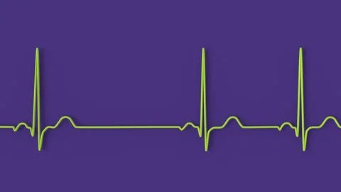 Electrocardiogram ECG displaying sinus arrhythmia, 3D illustration Stock Illustration