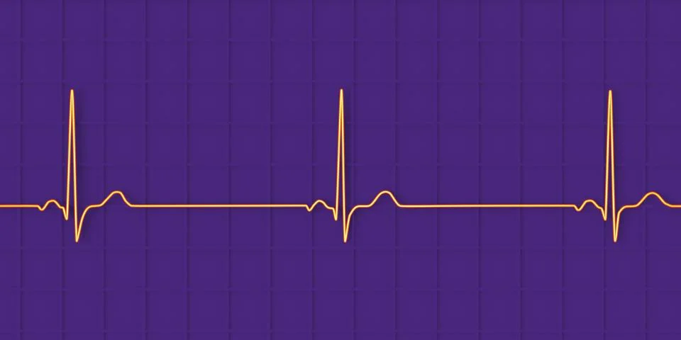 Electrocardiogram ECG displaying sinus bradycardia, 3D illustration Stock-Illustration