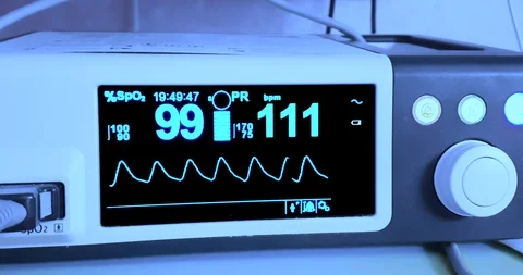 Electrocardiogram ecg in hospital surgery operating emergency room showing Video stock 103150366