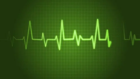 Electrocardiogram ECG line animation, representing heartbeats 库存影片 309887260
