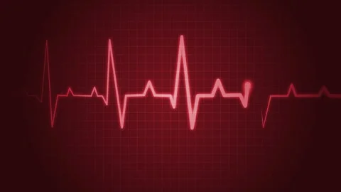 Electrocardiogram ECG line animation, symbolizing heart health and medical .. Stock Footage 309887358