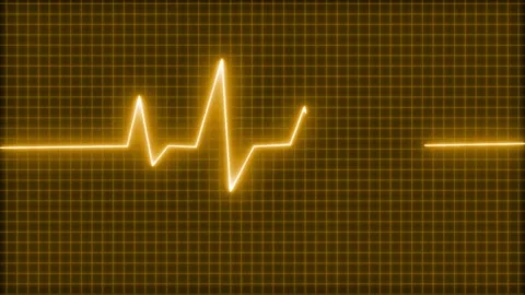 Electrocardiogram ECG Neon Pulse, Glowing Heartbeat Wave Animation Video stock 315002776