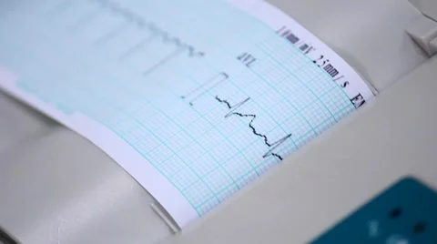Electrocardiogram 库存影片 7768150