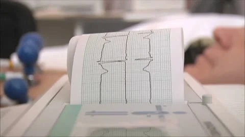 Electrocardiogram 스톡 동영상 8973162