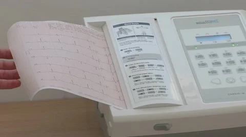 Electrocardiogram Stock Footage