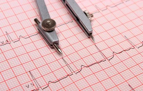 Electrocardiogram graph report and calipers Stock Photos