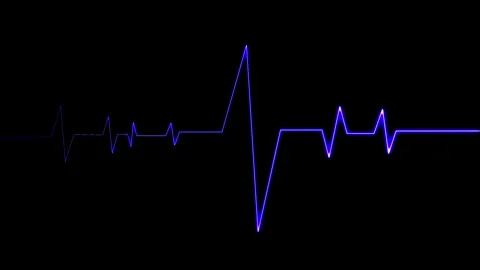 Electrocardiogram Heartbeat Graph Display Stock Footage 332468346