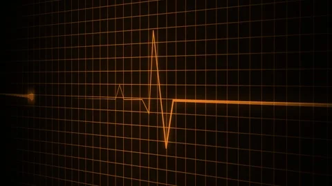 Electrocardiogram Heartbeat on Grid Animation, A electrocardiogram line on .. Stock-Footage 305194404