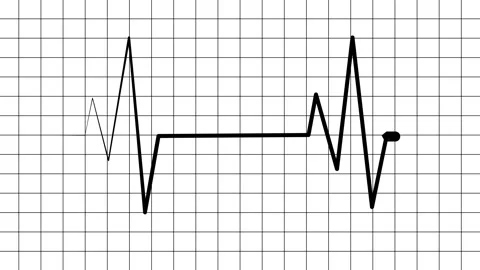 Electrocardiogram Heartbeat on Grid Background Animation, electrocardiogram.. 動画素材 305169376
