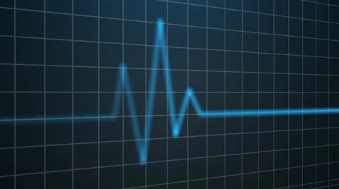 Electrocardiogram. Heartbeat waves Stock Footage 65464680