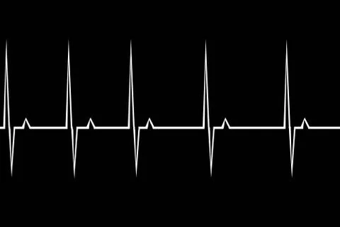 Electrocardiogram Stock Illustration