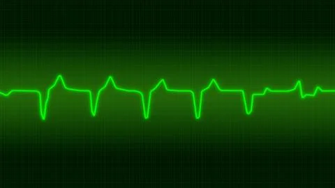 Electrocardiogram Illustrazione stock