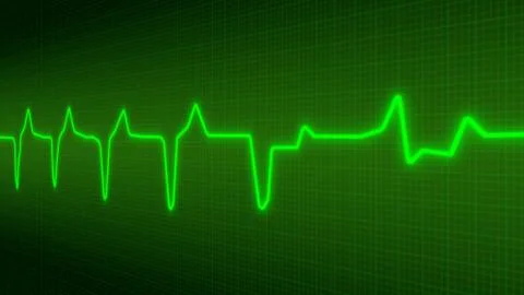 Electrocardiogram Ilustración de archivo