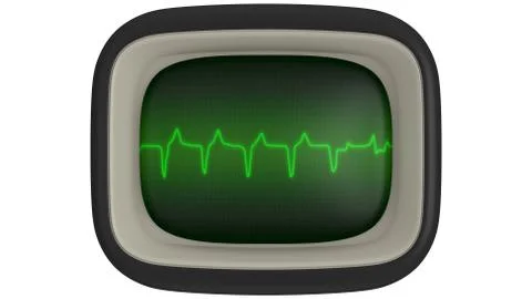 Electrocardiogram Ilustración de archivo