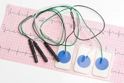 Electrocardiogram leads Stock Photos