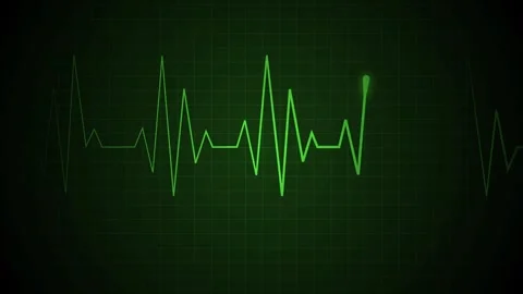 Electrocardiogram line heartbeat pulse and medical monitoring concept animati Stock Footage 340384574