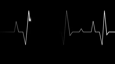 Electrocardiogram line heartbeat trace with sharp peaks and minimal design .. Stock Footage 340385777