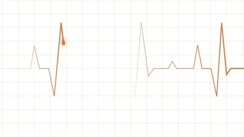 Electrocardiogram line heartbeat trace with sharp peaks and minimal design .. Stock Footage 340385783