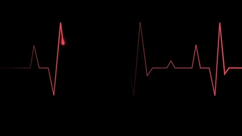 Electrocardiogram line heartbeat trace with sharp peaks and minimal design .. Stock Footage 340386632