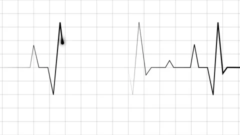 Electrocardiogram line heartbeat trace with sharp peaks and minimal design .. Stock Footage 340387048
