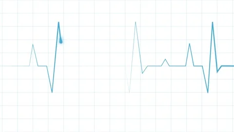 Electrocardiogram line heartbeat trace with sharp peaks and minimal design .. Stock Footage 340387310
