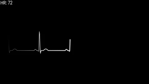 Electrocardiogram line pattern representing a cardiac rhythm heart trace. Stock Footage 337730837