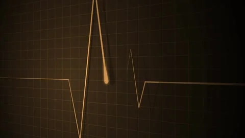 Electrocardiogram line showing a heartbeat on a grid medical and healthcare.. Stock-Footage 340385192