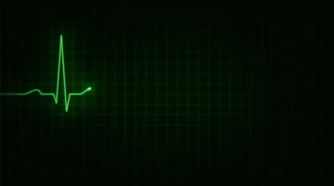 Electrocardiogram. Loopable. 3 in 1. Green. More color options in my portfolio. Stock Footage 59579491
