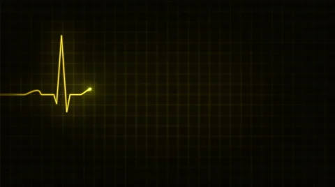 Electrocardiogram. Loopable. 3 in 1. Yellow. More color options in my portfolio. Stock Footage 59579473