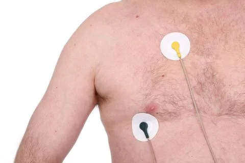 Electrocardiogram Stockfoto's