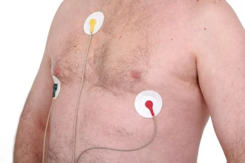 Electrocardiogram 库存照片