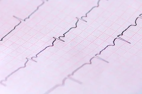 Electrocardiogram Stock Photos