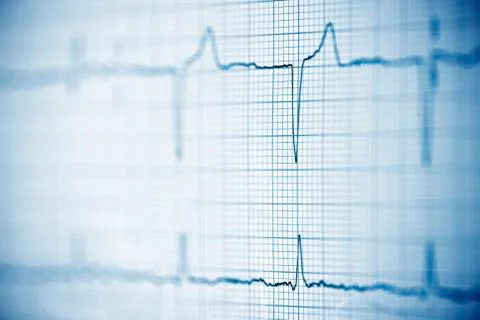 Electrocardiogram Stock Photos