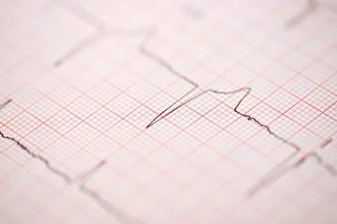 Electrocardiogram Stock Photos