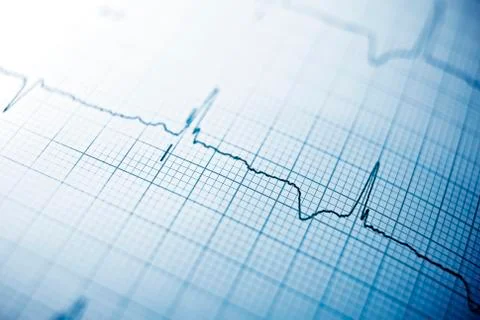Electrocardiogram Stock Photos