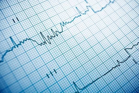 Electrocardiogram Stock Photos
