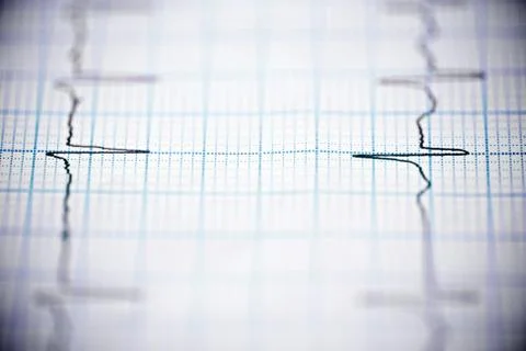Electrocardiogram Foto stock