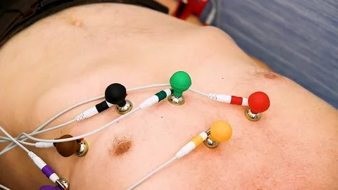 Electrocardiogram Procedure for Diagnosing Heart Disease Stock Footage 237384237