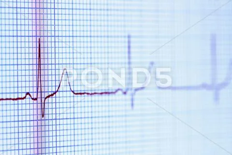 Electrocardiogram (Pulse Trace) Displayed On A Digital Tablet Screen