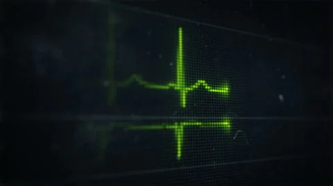 Electrocardiogram screen closeup Stock Footage 42152829
