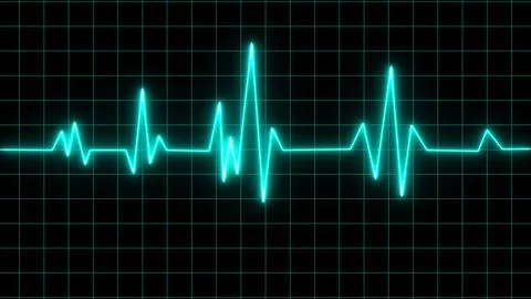 Electrocardiogram show pulse rate graph ,Heart beat ,ECG ,EKG  interpretati.. Stock Illustration