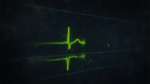 Electrocardiogram showing resuscitation Stock Footage 42152823