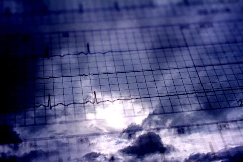 Electrocardiogram tracing that ends in clouds. Passage to heaven or the aft.. Fotos de archivo