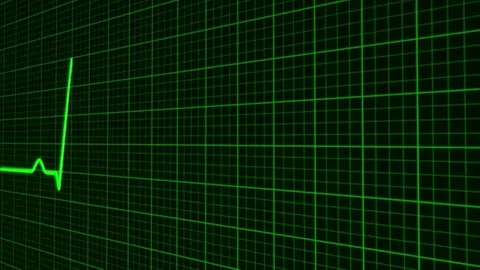 Electrocardiogram visualization Stock Footage 98247185